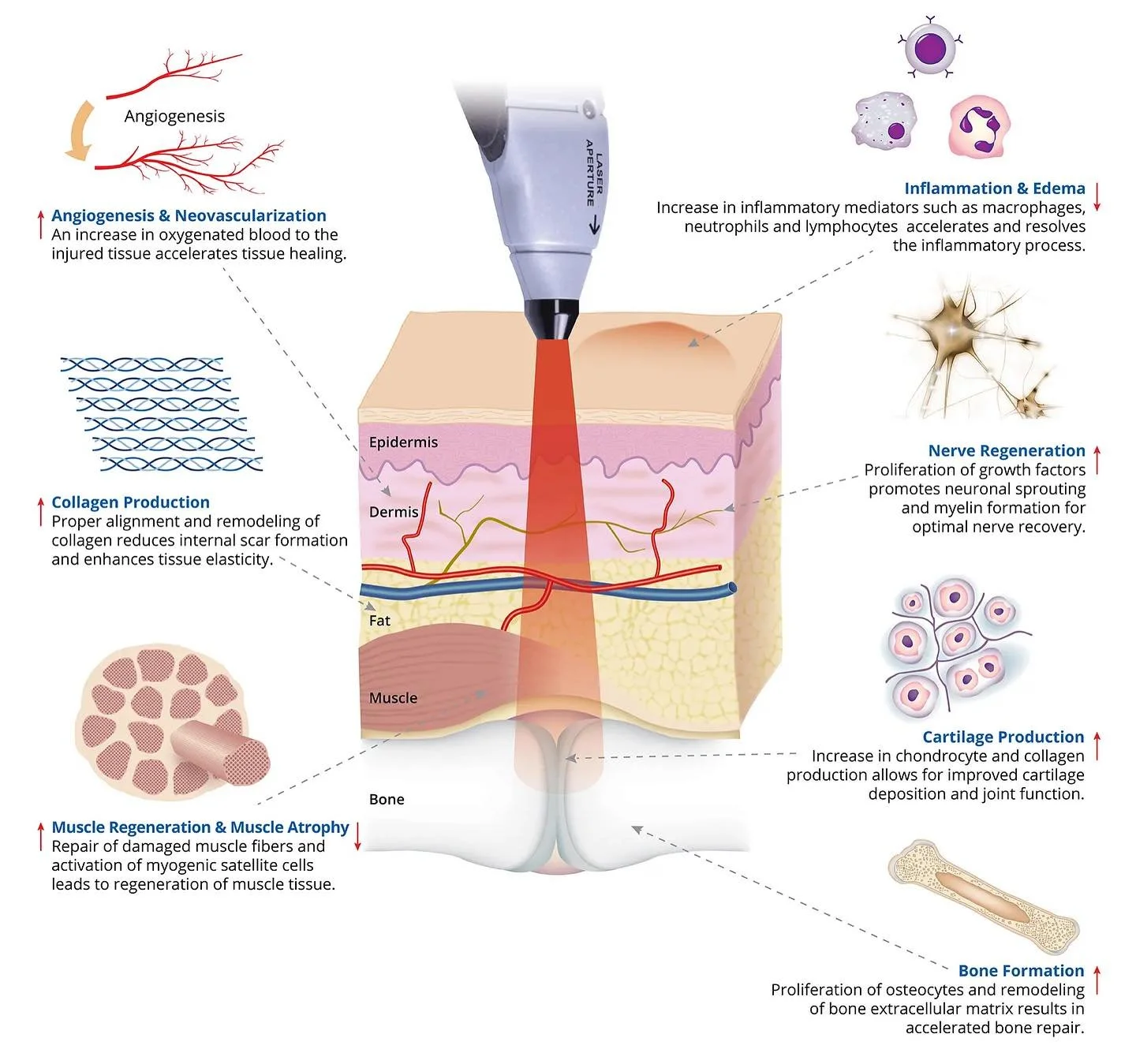 Clinical Effects of Bioflex Laser Therapy. Available at Maplecreek Vernon and Kelowna Locations.