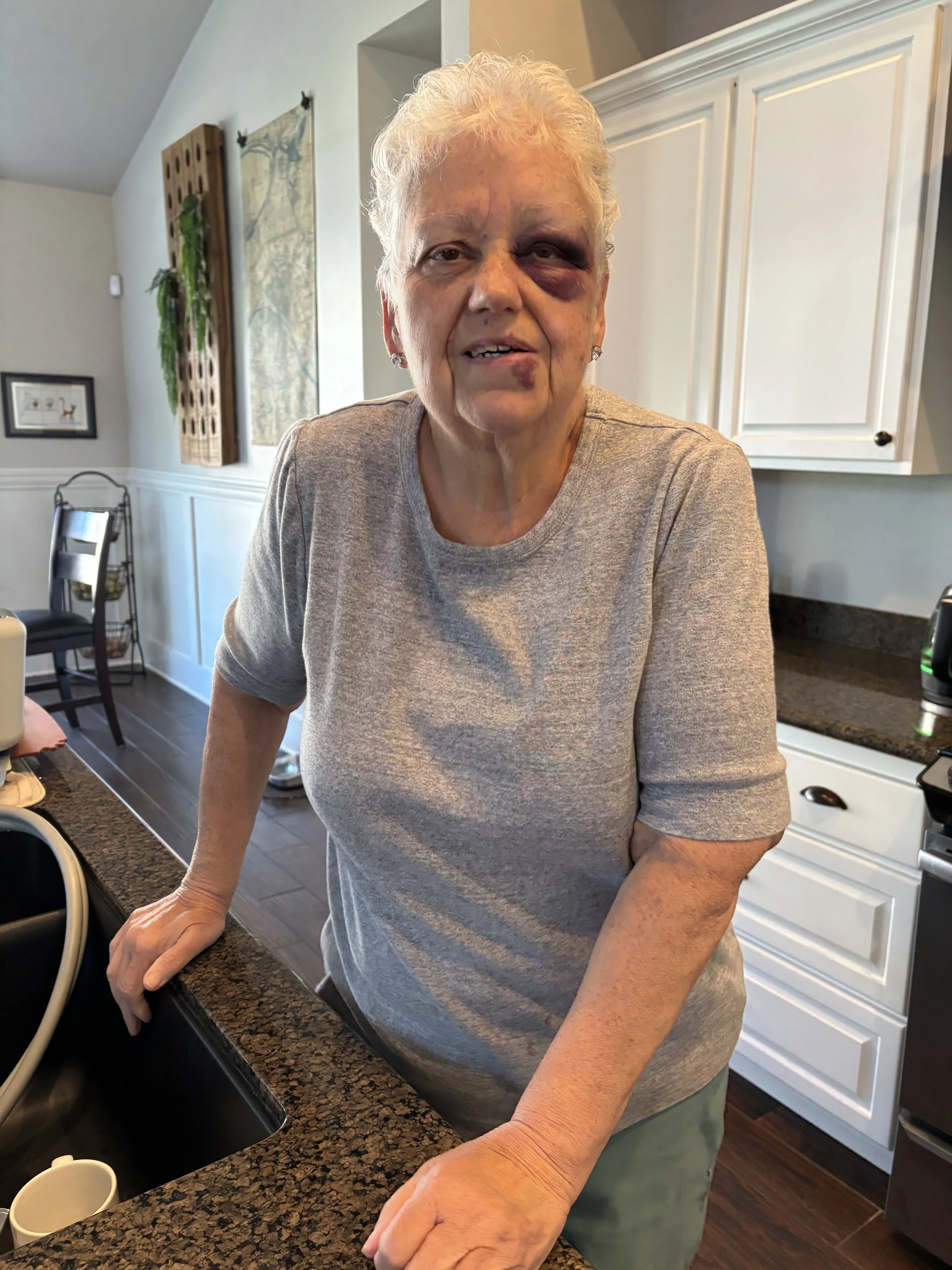 There may have been a bit of a spill on a bicycle...and then...