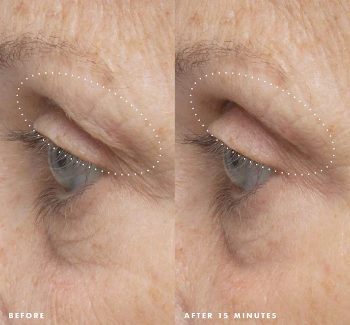ClinicalInset-Firm-TasticEyes2.webp
