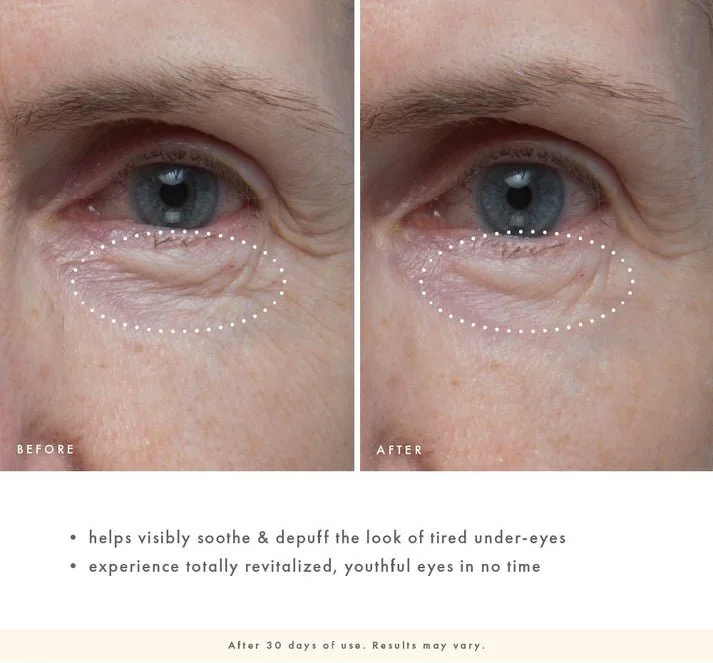 Firm-Tastic_Eyes-Consumer_Survey-BA_2.jpg