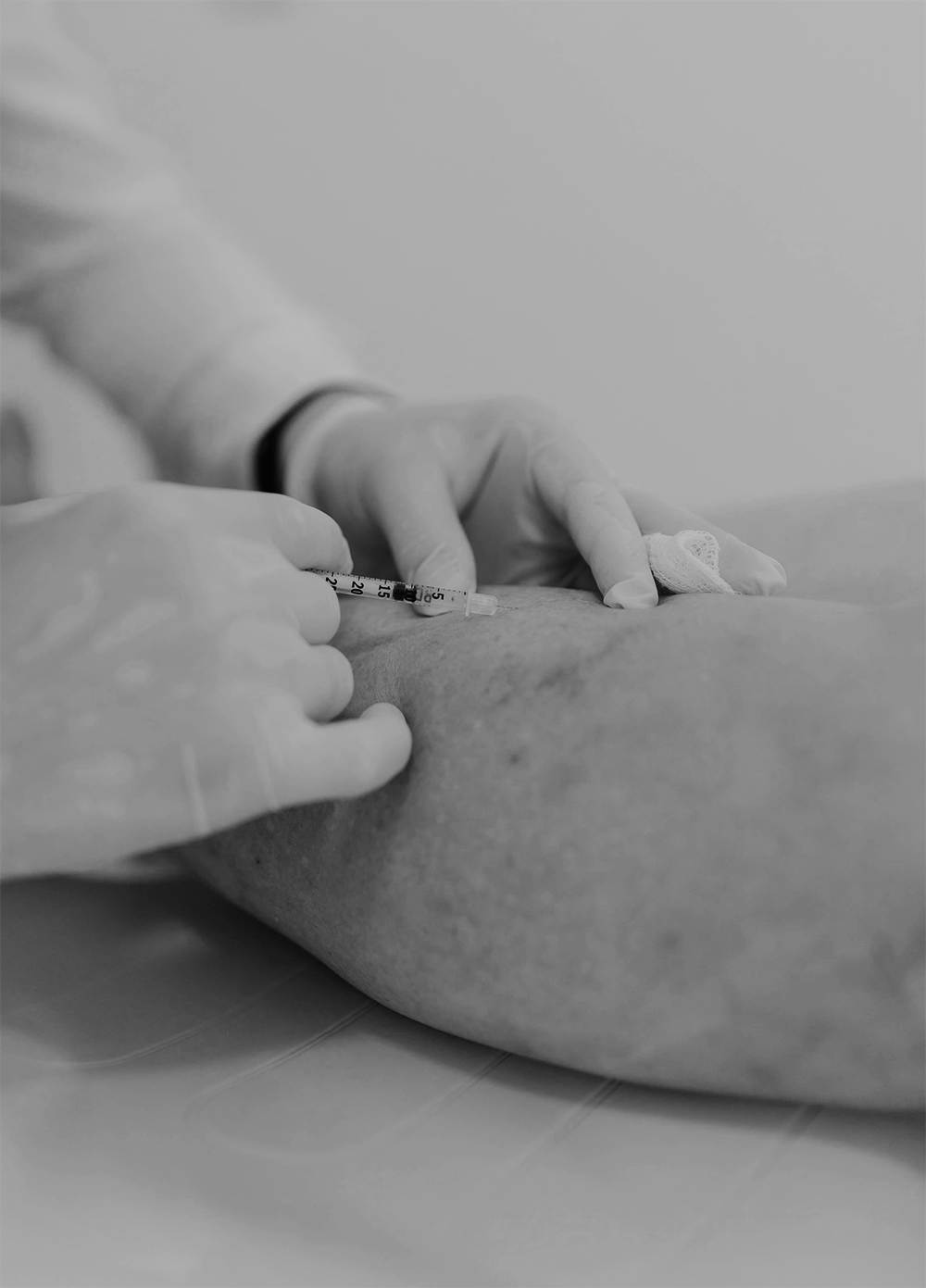 Vein Treatment