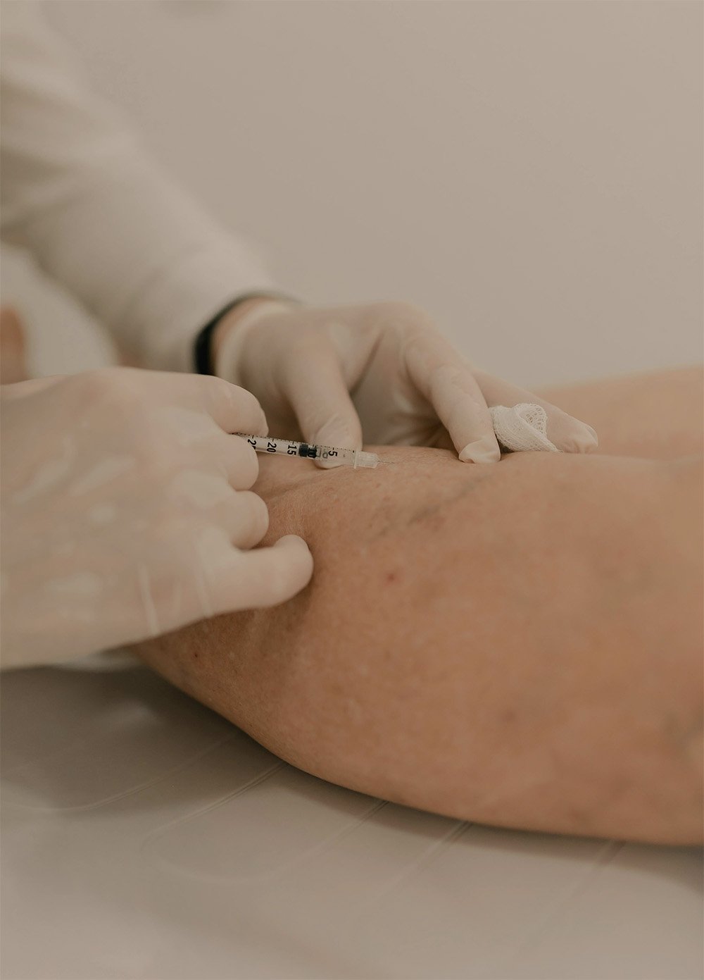 Vein Treatments