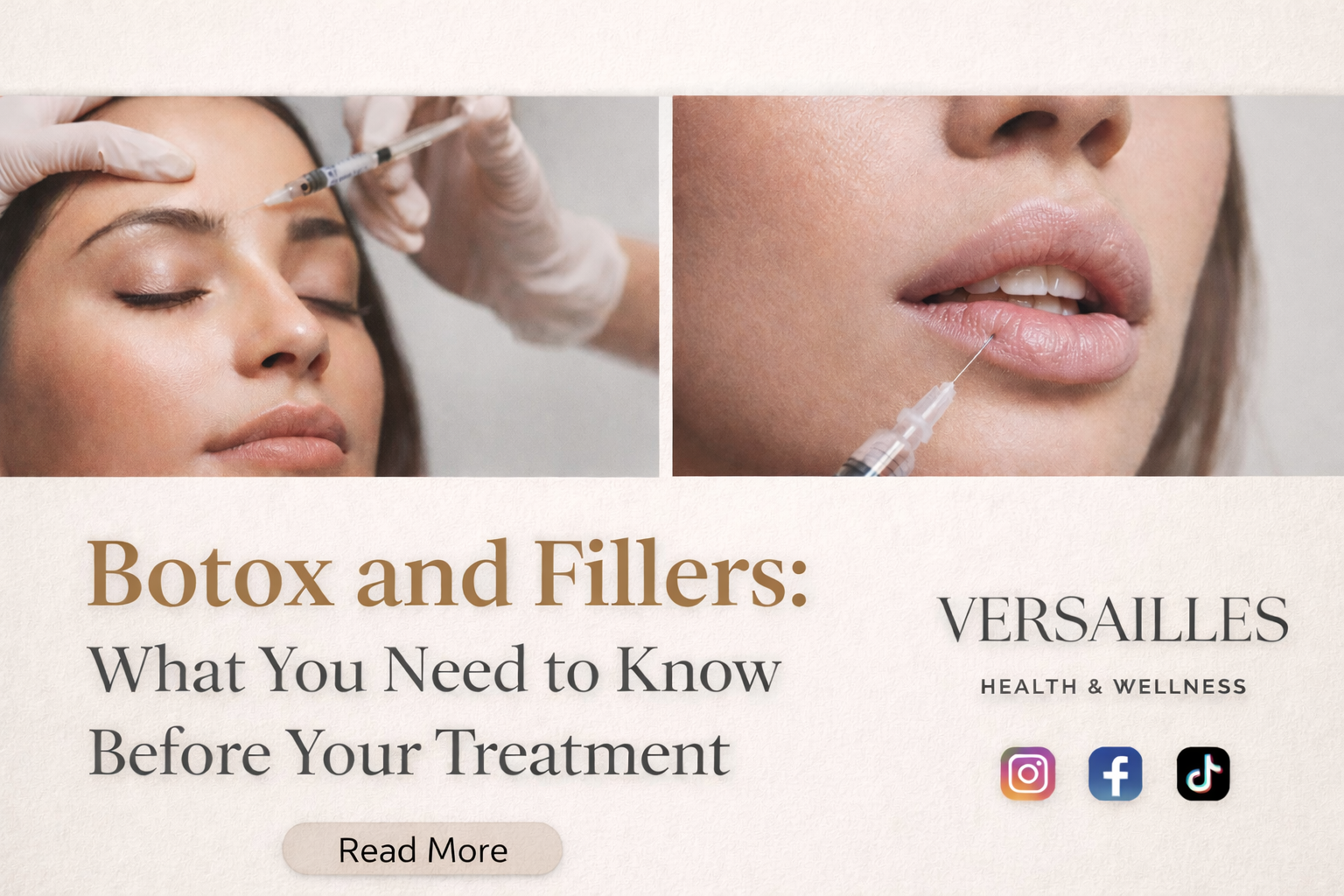 Botox and Fillers: What You Need to Know Before Your Treatment
