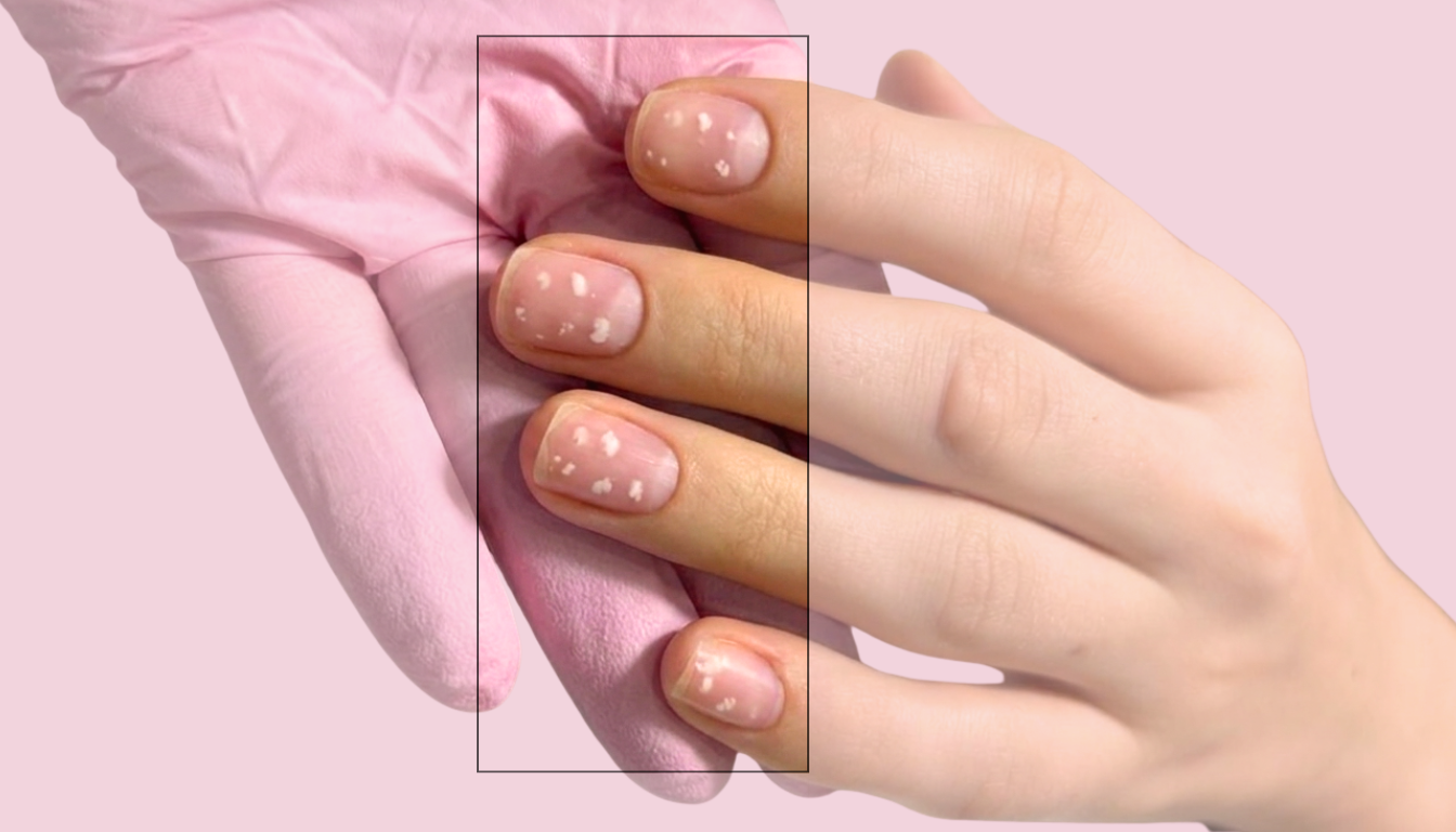 White Spots on Your Nails? Here’s What They Really Mean.