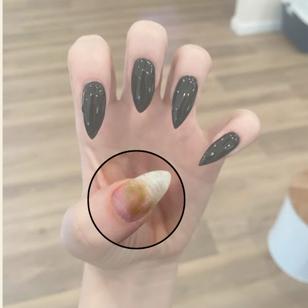 Green Nail After Gel or Acrylic? Here's What It Actually Means
