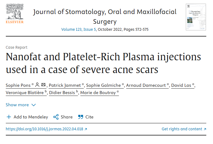 Nanofat and platelet-rich plasma (PRP) in the treatment of inflammatory acne scars: a case report