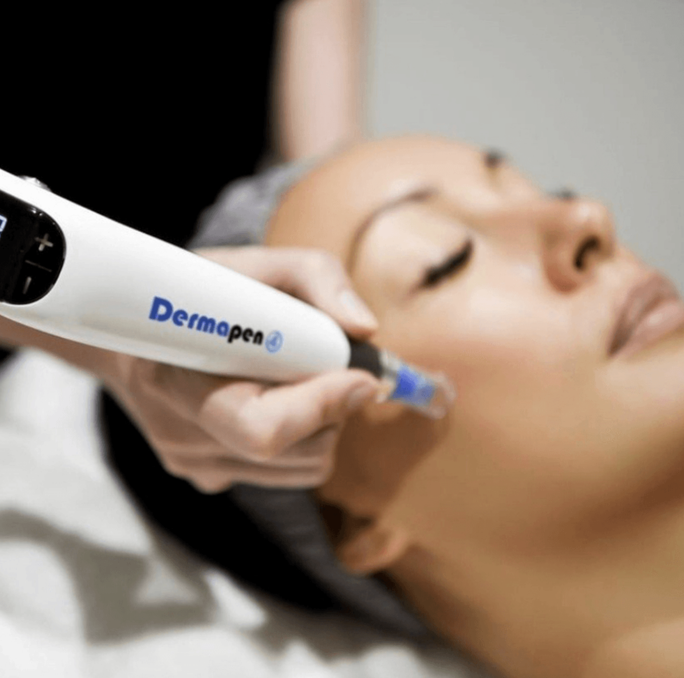 A woman receiving a facial treatment with a DermaPen device during a skincare procedure.