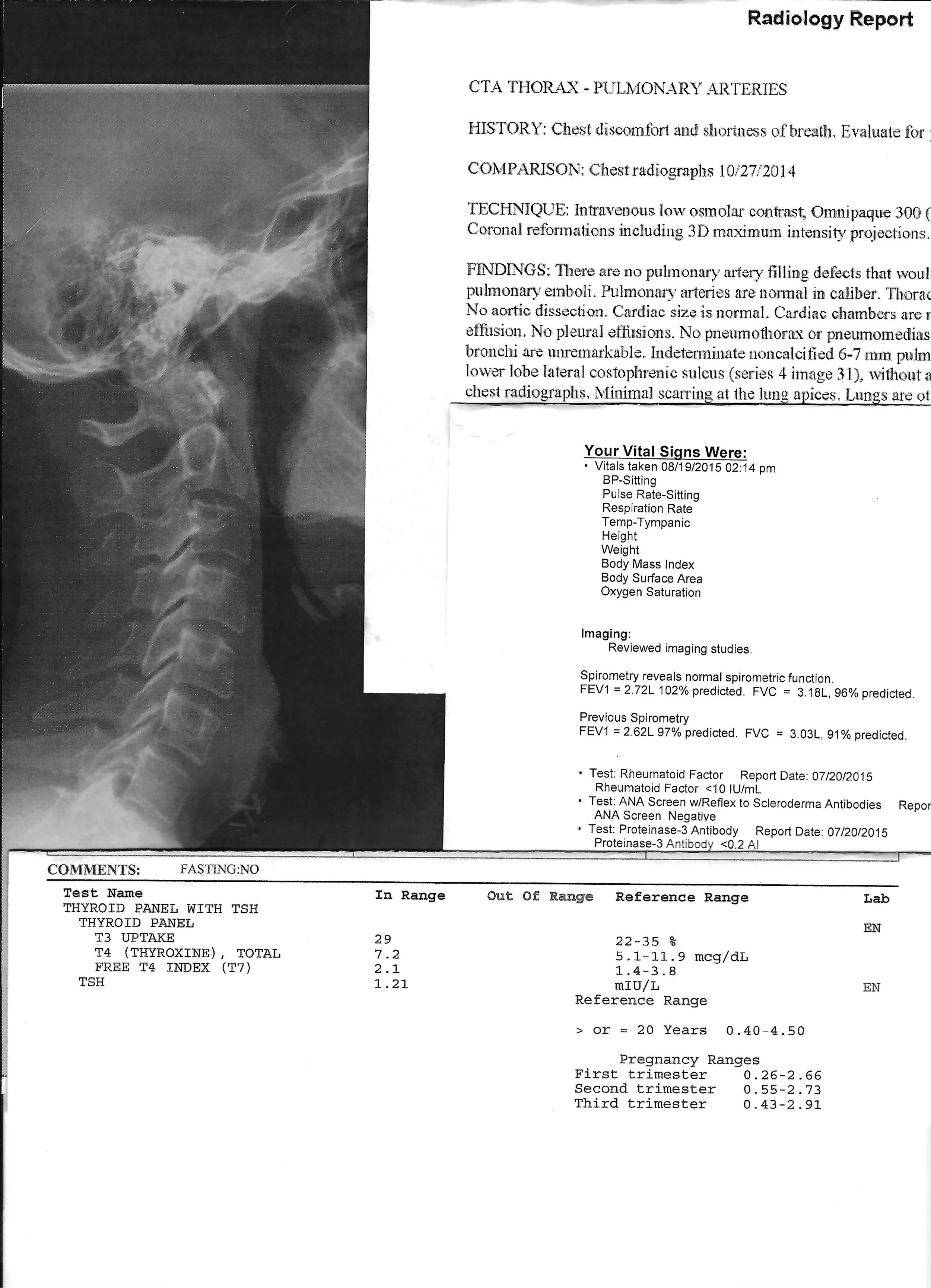 Radiology report with an X-ray image of a person's neck and chest area on the left side, and detailed medical findings and test results on the right side.