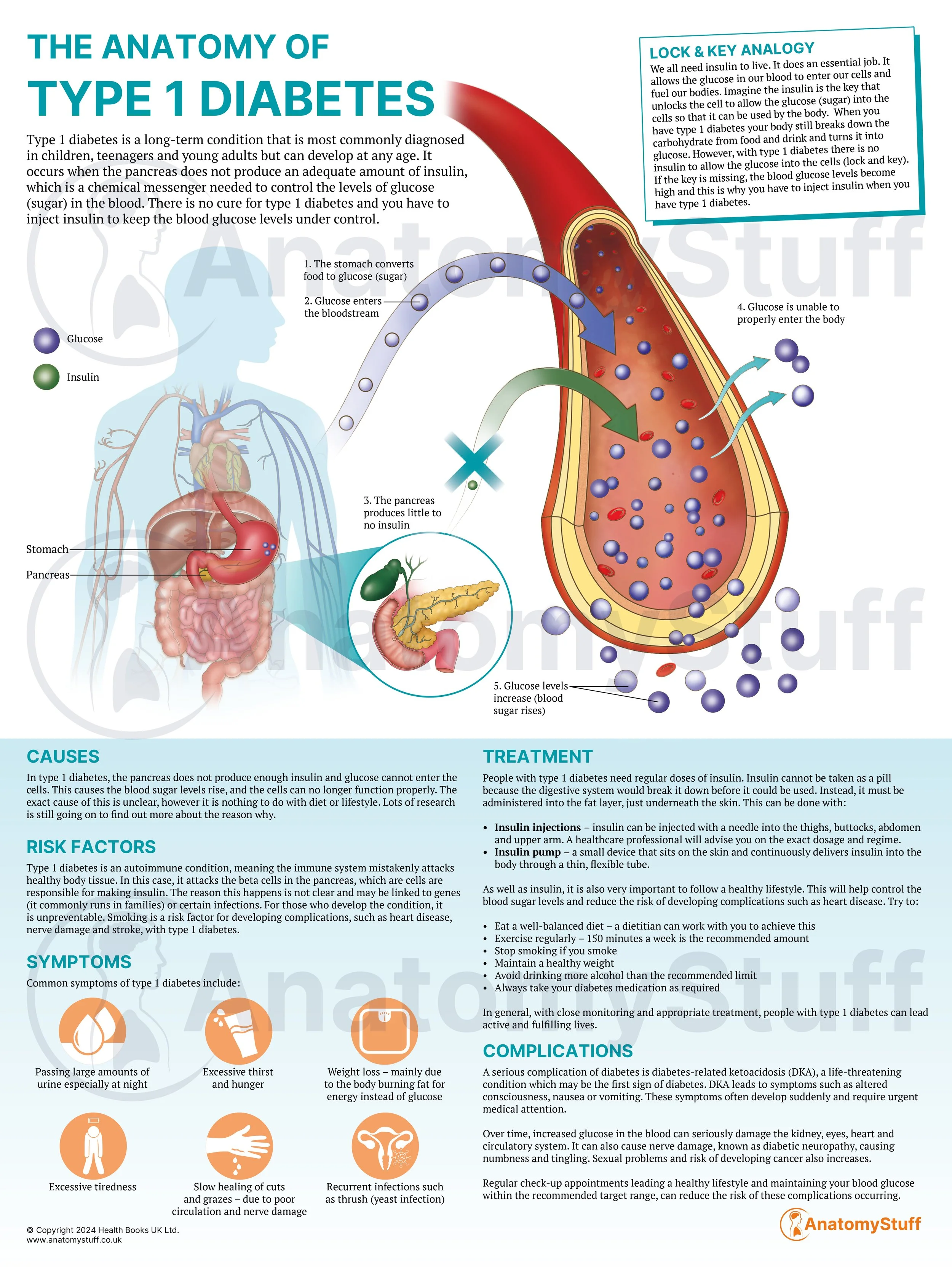 The Anatomy of Type 1 Diabetes
