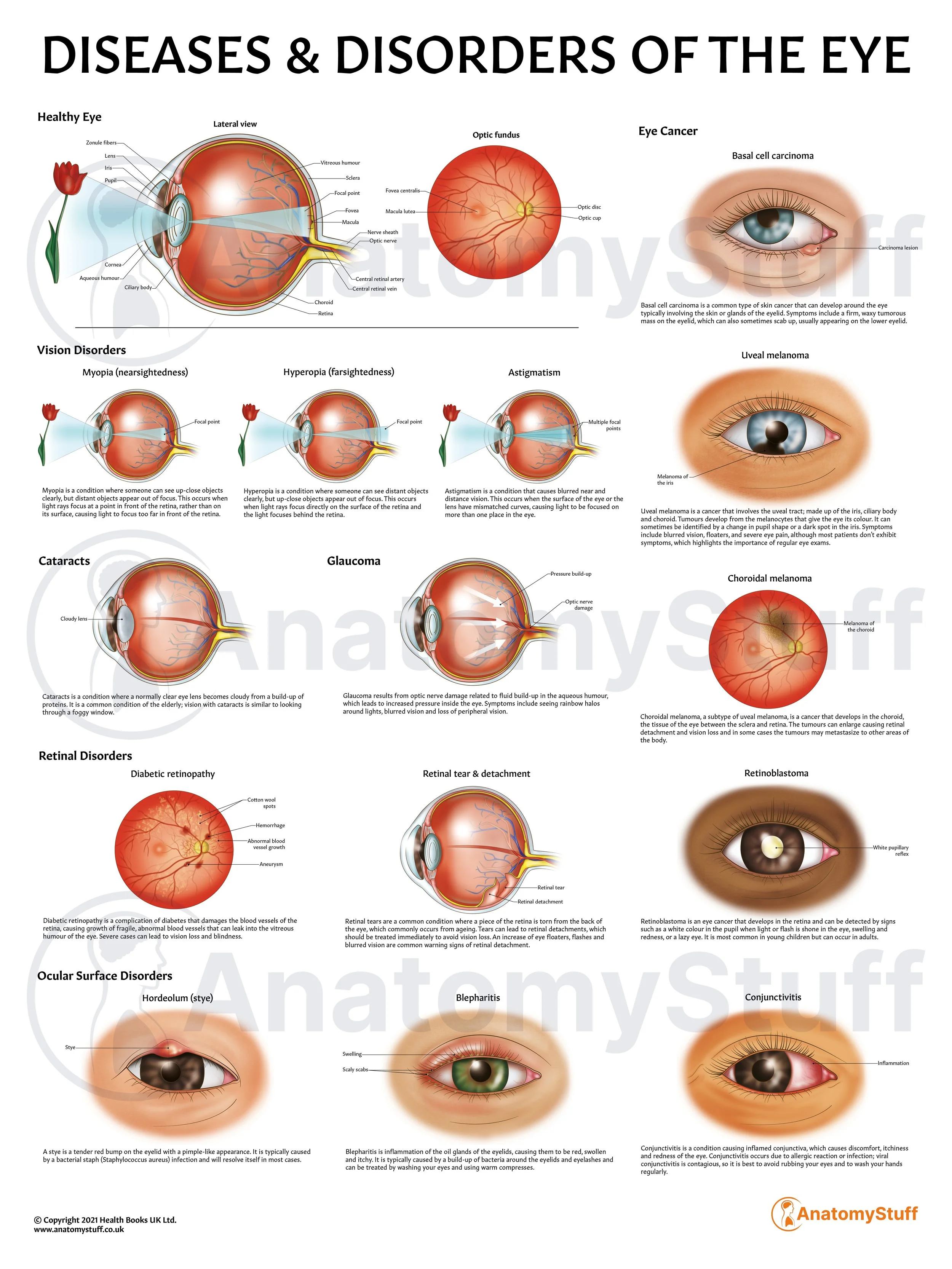Diseases & Disorders of the Eye