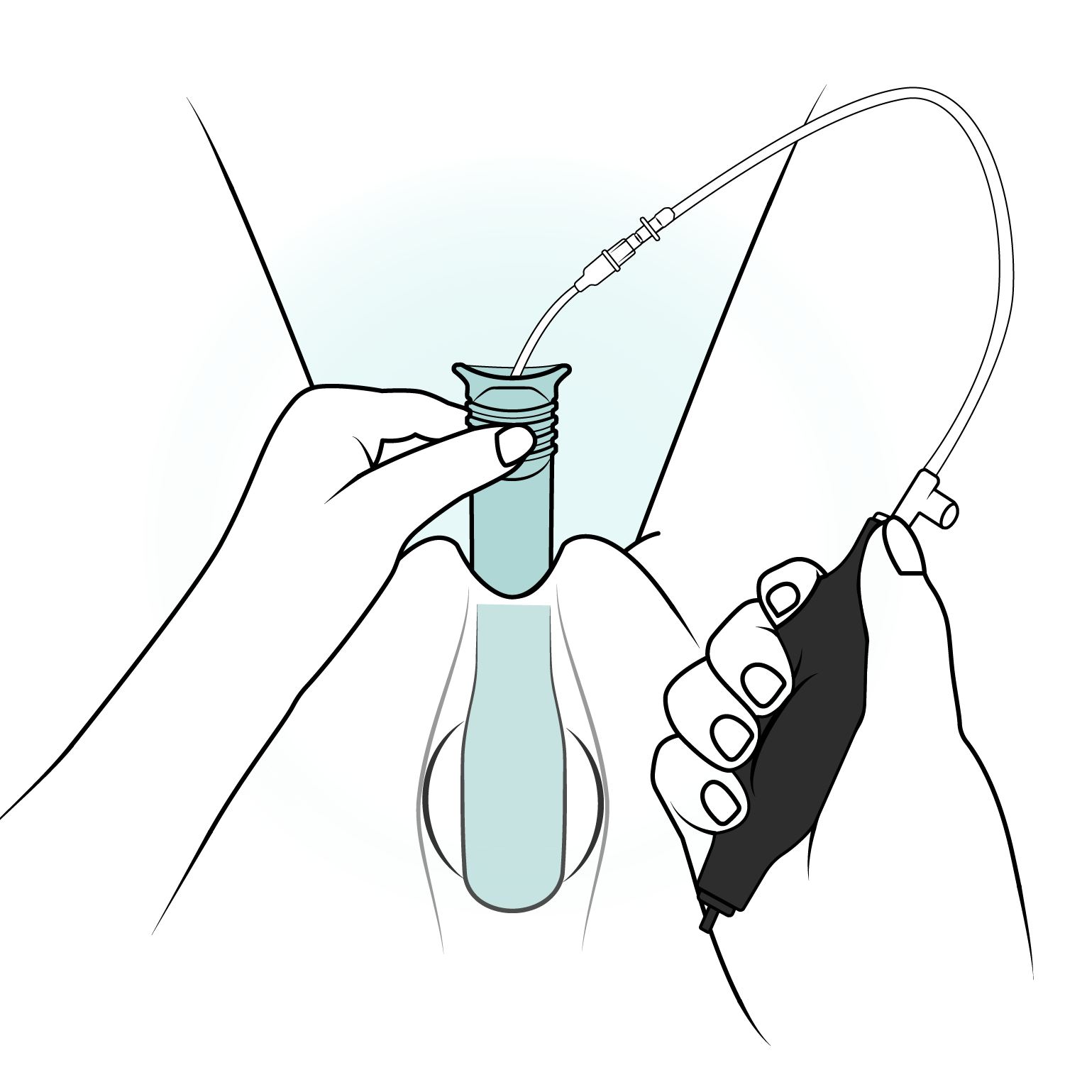 FemTx Technical IFU-v04-06.png