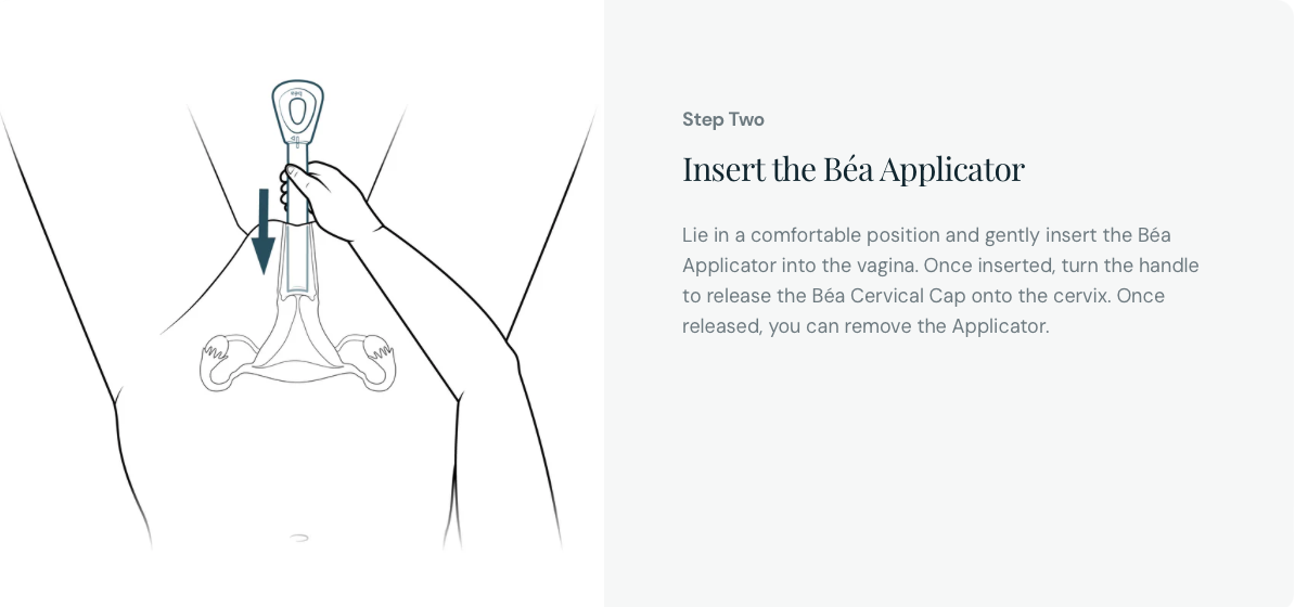 Insert Device Applicator Illustration