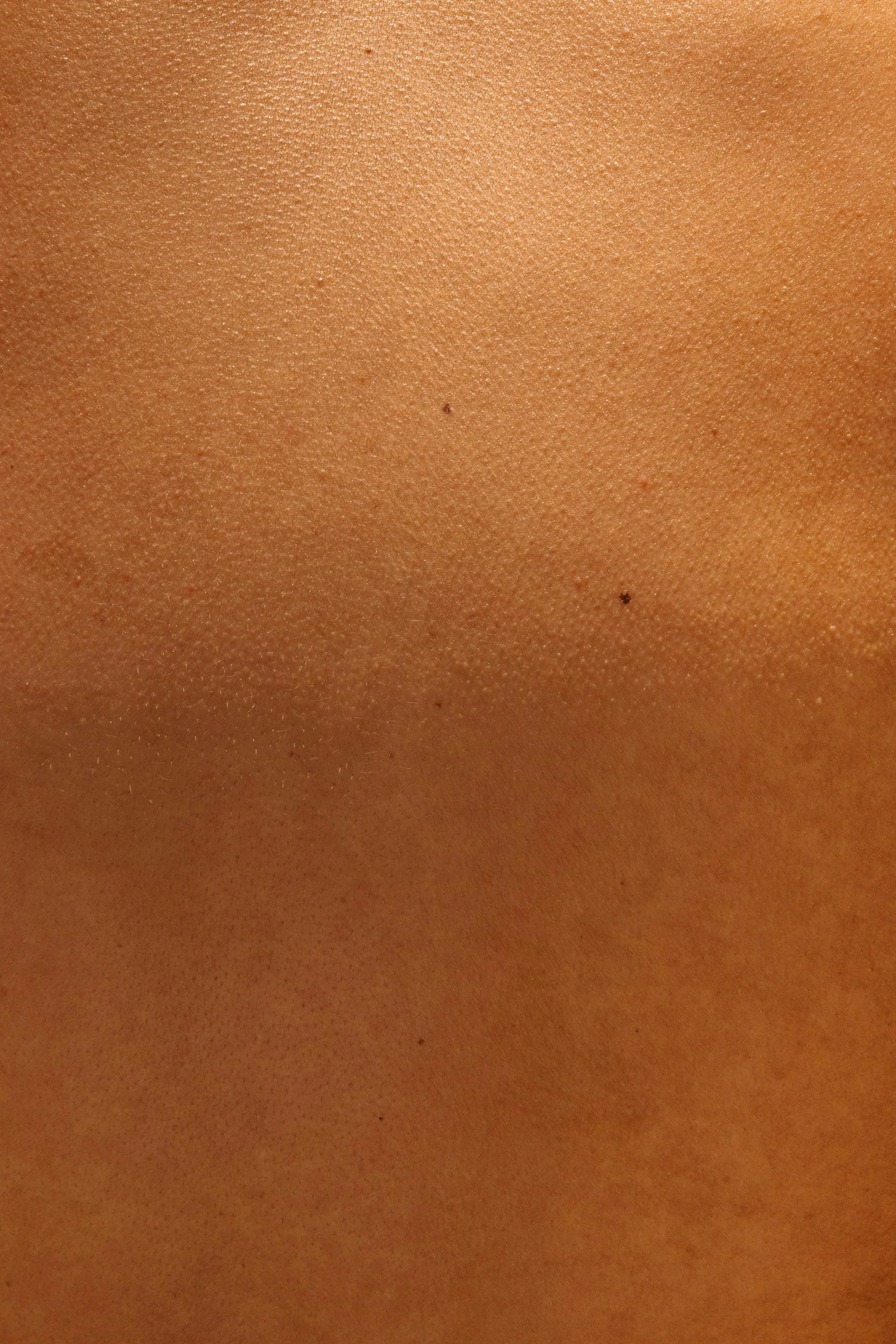 Closeup camera shot of skin