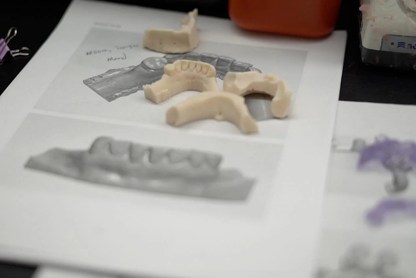 Before the final smile, there&rsquo;s the strategy. Careful planning, custom frameworks, and a workflow built for predictable results.

If you&rsquo;re placing full-arch cases, let&rsquo;s build them right from the start.