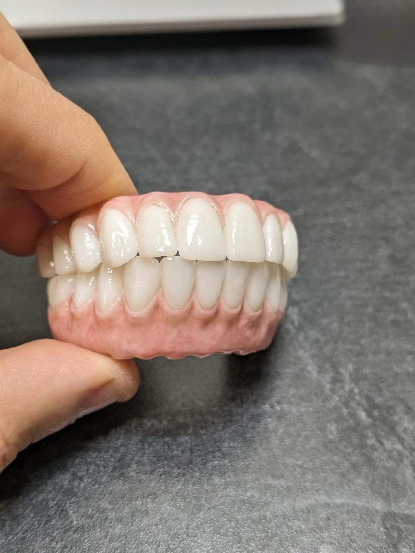 Quality You Can Feel. While you focus on your patients, we handle the heavy lifting of manufacturing. We never cut corners; we use high-performance materials and expert finishing techniques to produce a restoration that looks natural and performs per