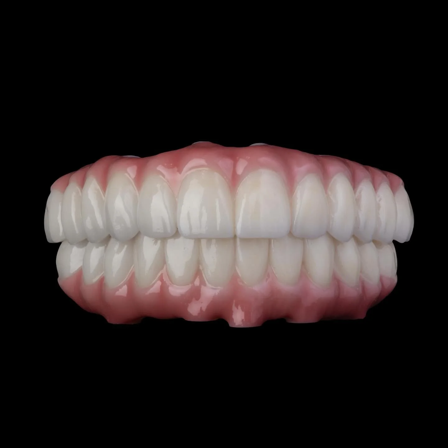 True luxury lies in the details, and our full-arch restorations reflect that at every stage&mdash;from precise Exocad design to impeccable finishing, with quality you can both see and feel.