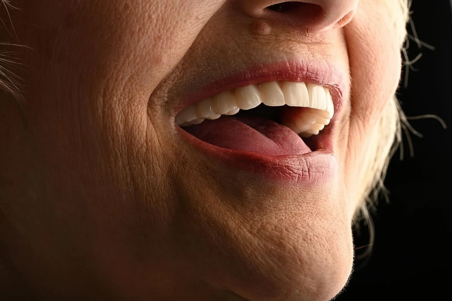 Full-arch dentistry is the most complex procedure in the practice. It requires surgical precision and clinical focus. The last thing a doctor needs is a lab workflow that feels like a second job.

We exist to make the complex feel effortless, but mos