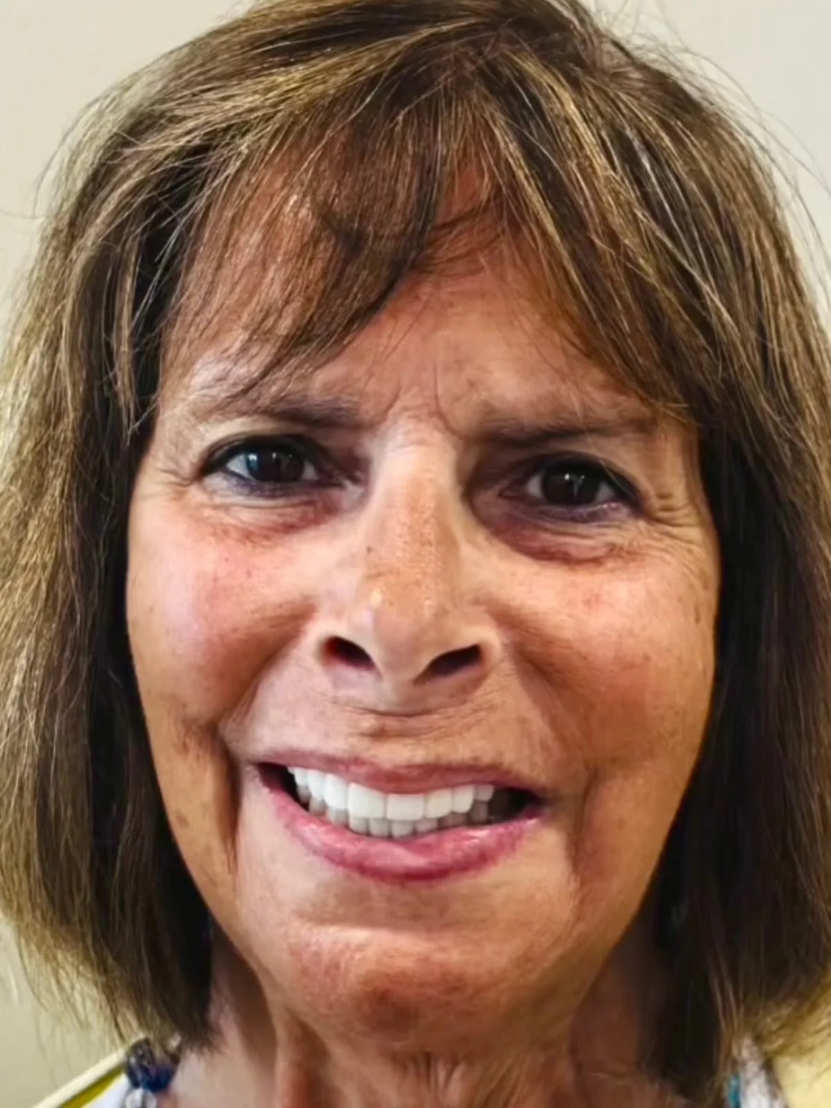After ➡️ Before.

We exist to simplify the most complex procedure in dentistry. So doctors can focus on delivering confident smiles and patients can leave happier, healthier, and ready to enjoy life again.