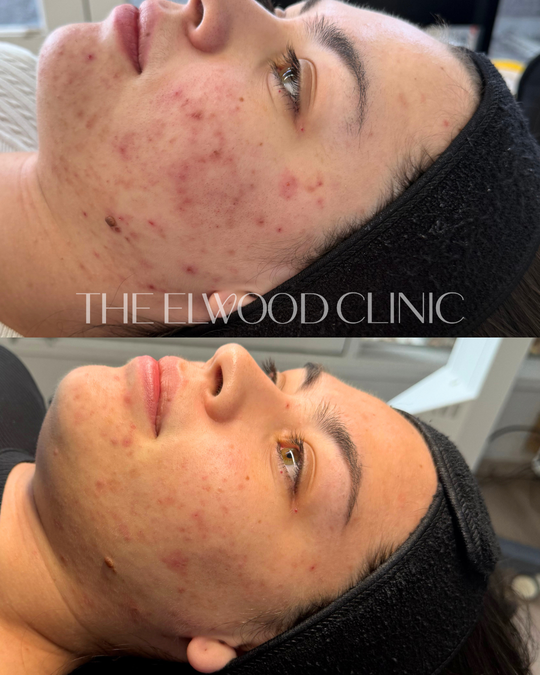Member Before & After 1.PNG