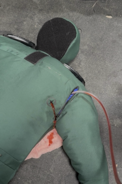 A person lying on the ground wearing a green jacket with a strapped device and a tube attached, possibly indicating a medical emergency or accident.