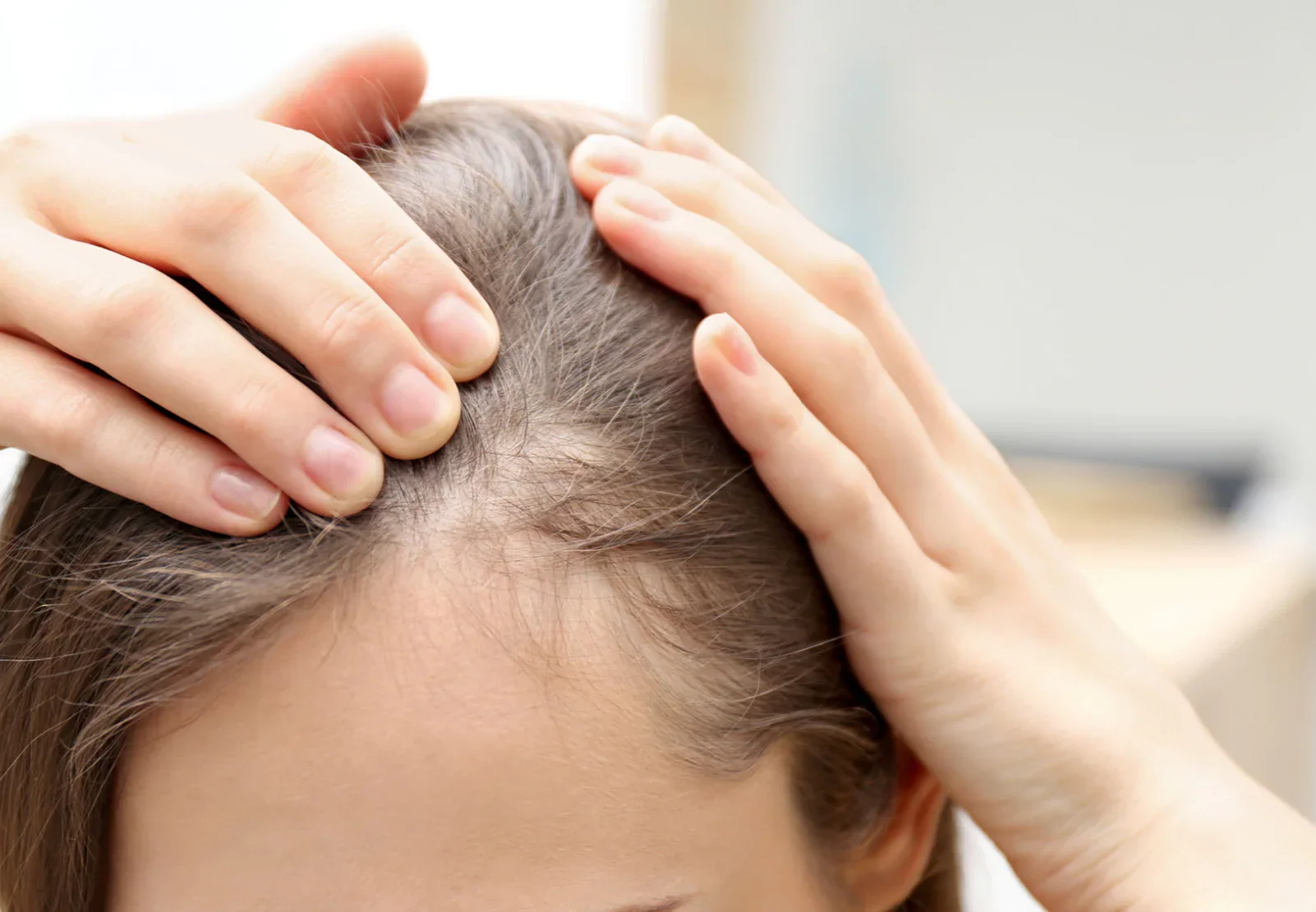 Why Hair Can Start Thinning in Your 30s and 40s (And What Can Help)