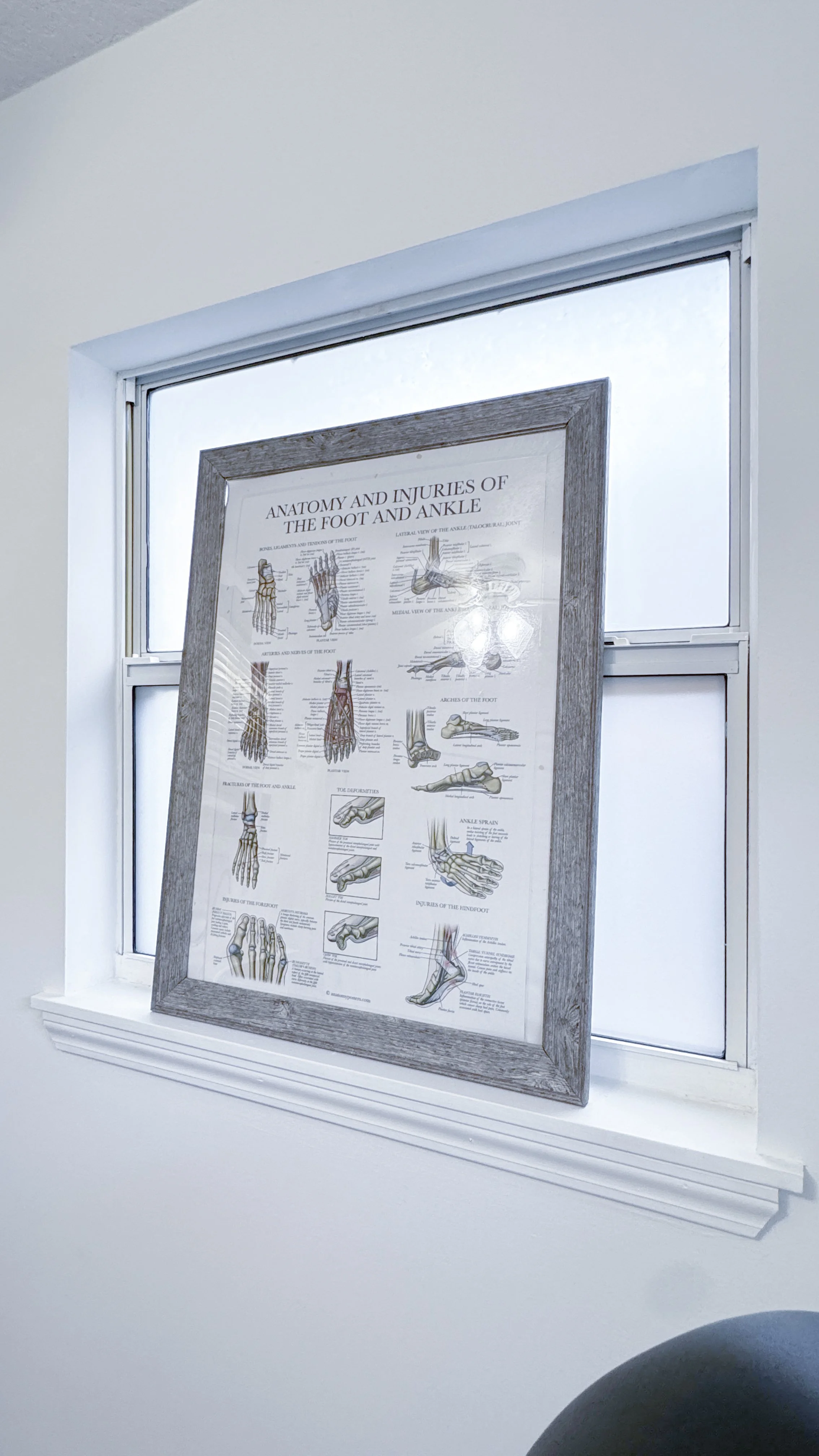 Photo of a framed blueprint of an anatomy of injuries of the foot and ankle