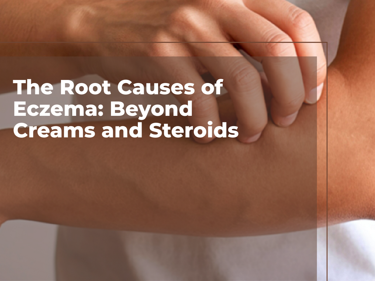 The Root Causes of Eczema: Beyond Creams and Steroids