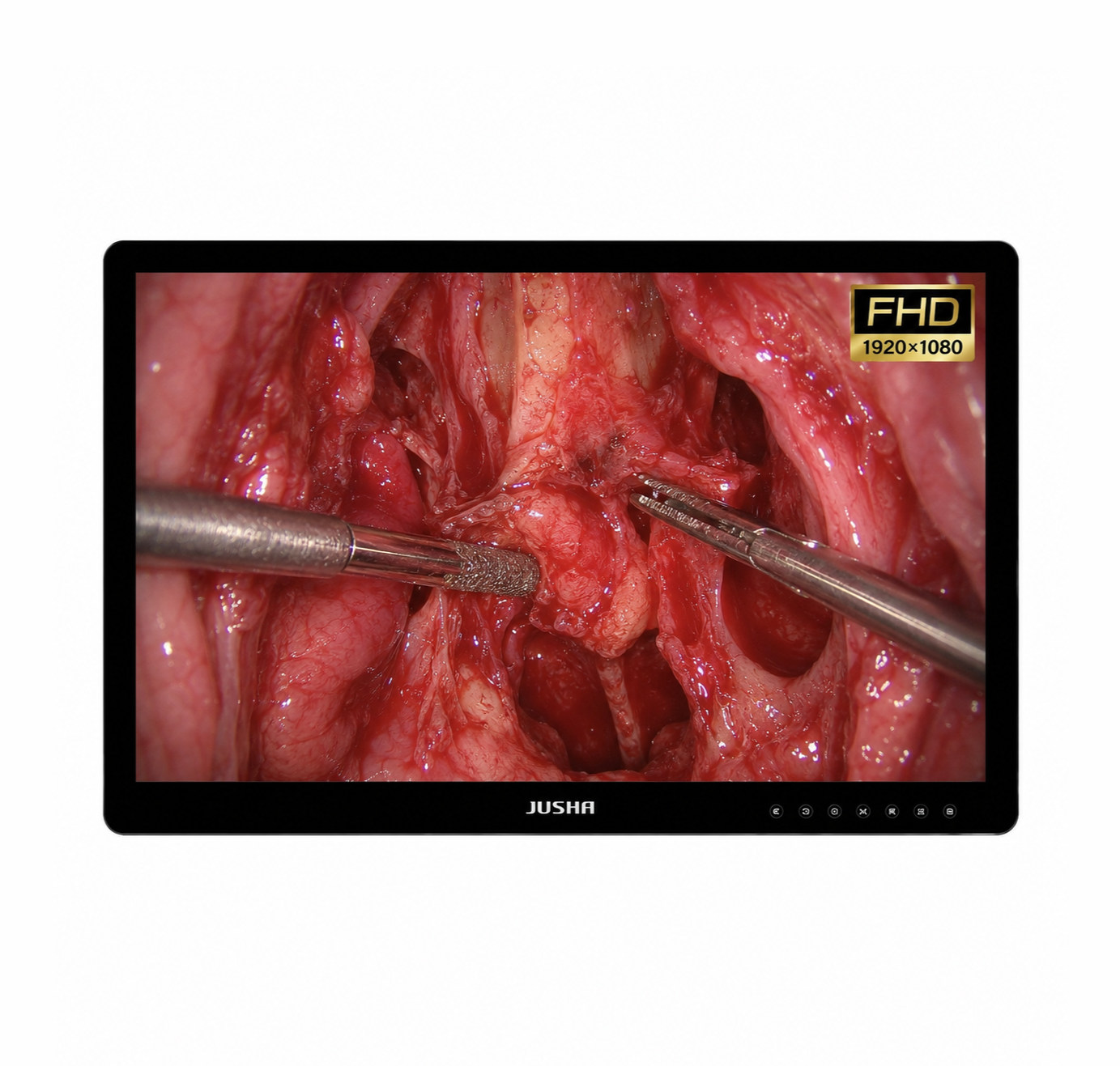 E270A1G - 27" FHD