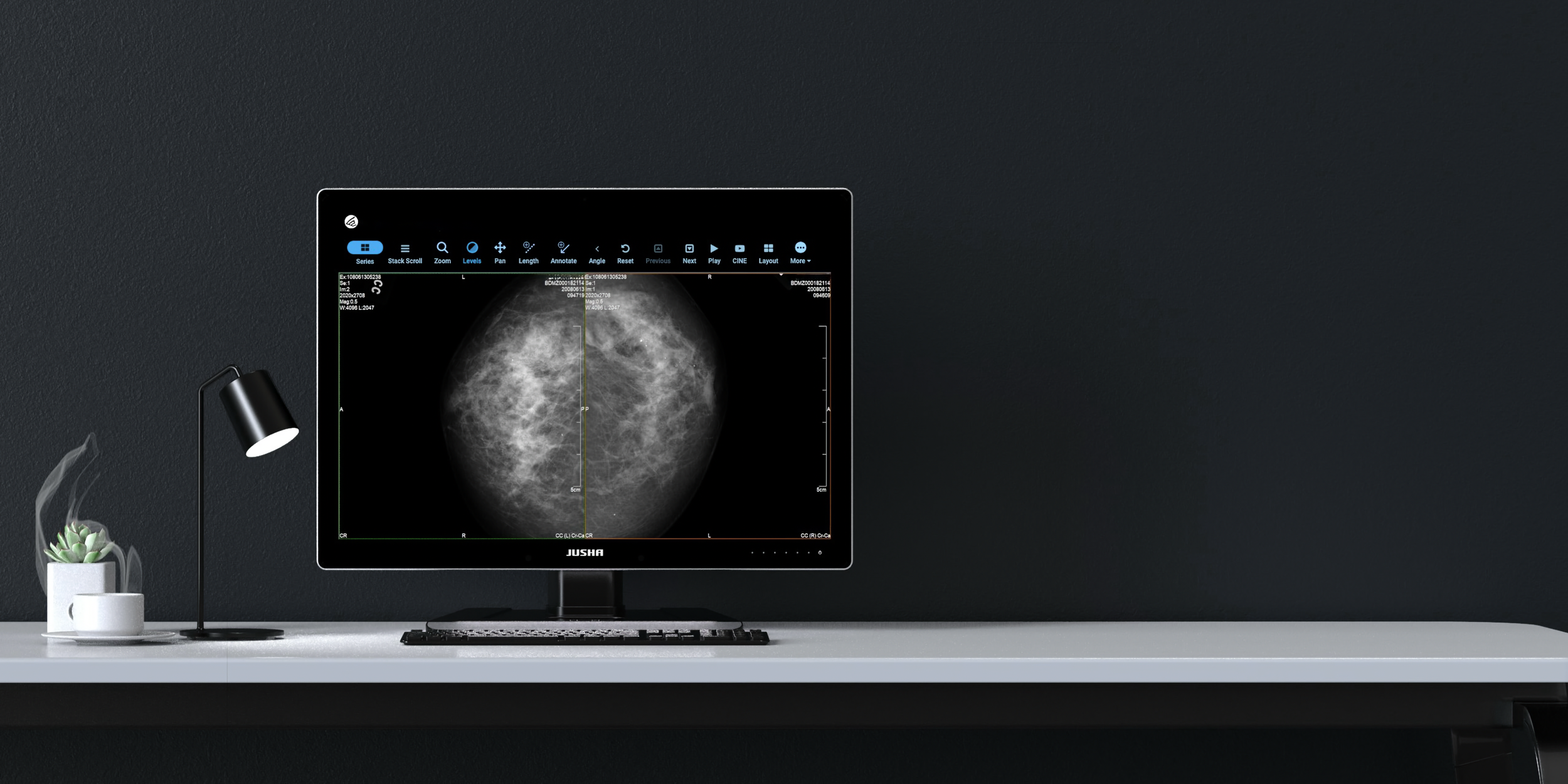 Computer monitor displaying a mammogram image on a white desk, with a small potted plant and a desk lamp nearby against a dark wall.
