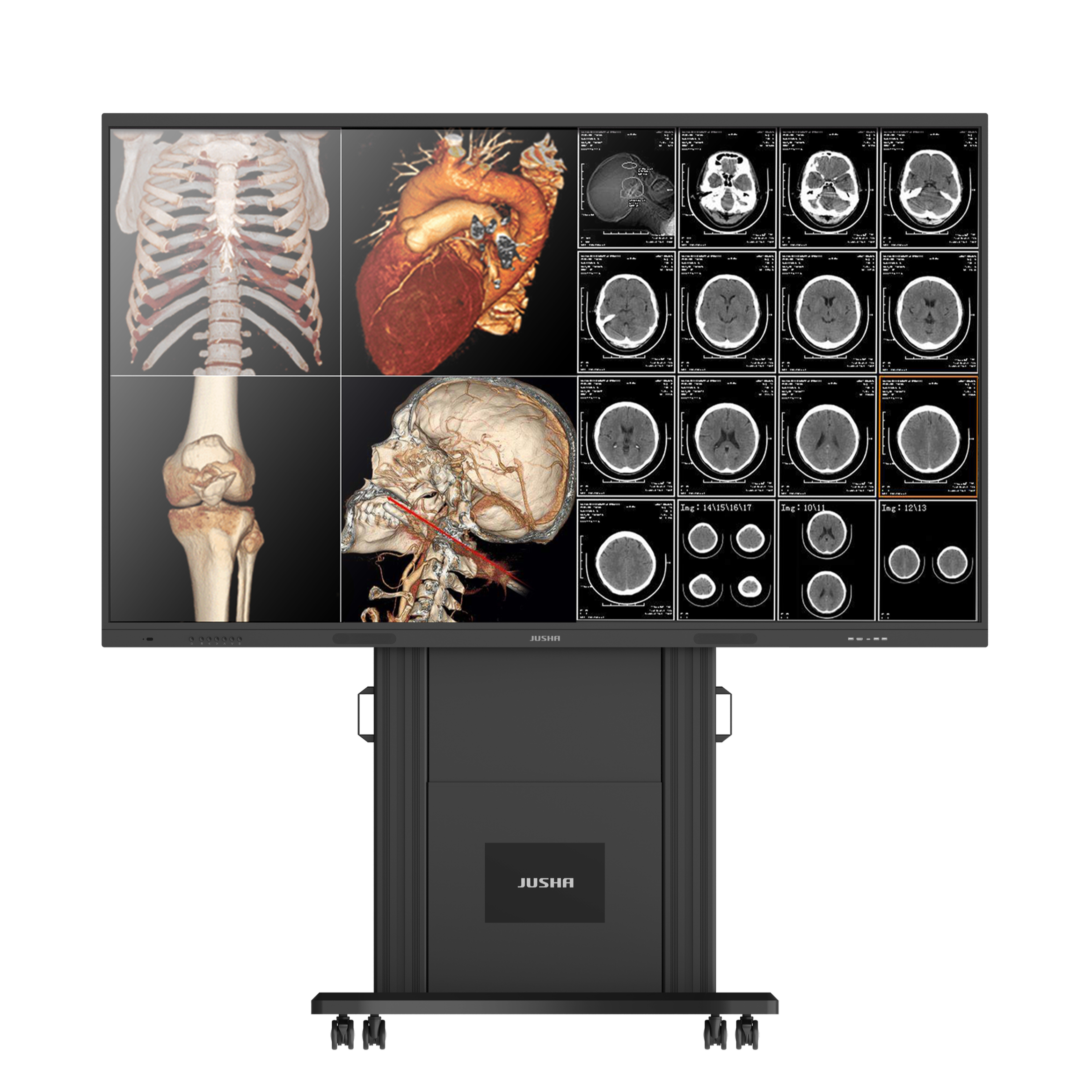 S9820A - 98" MDT Monitor