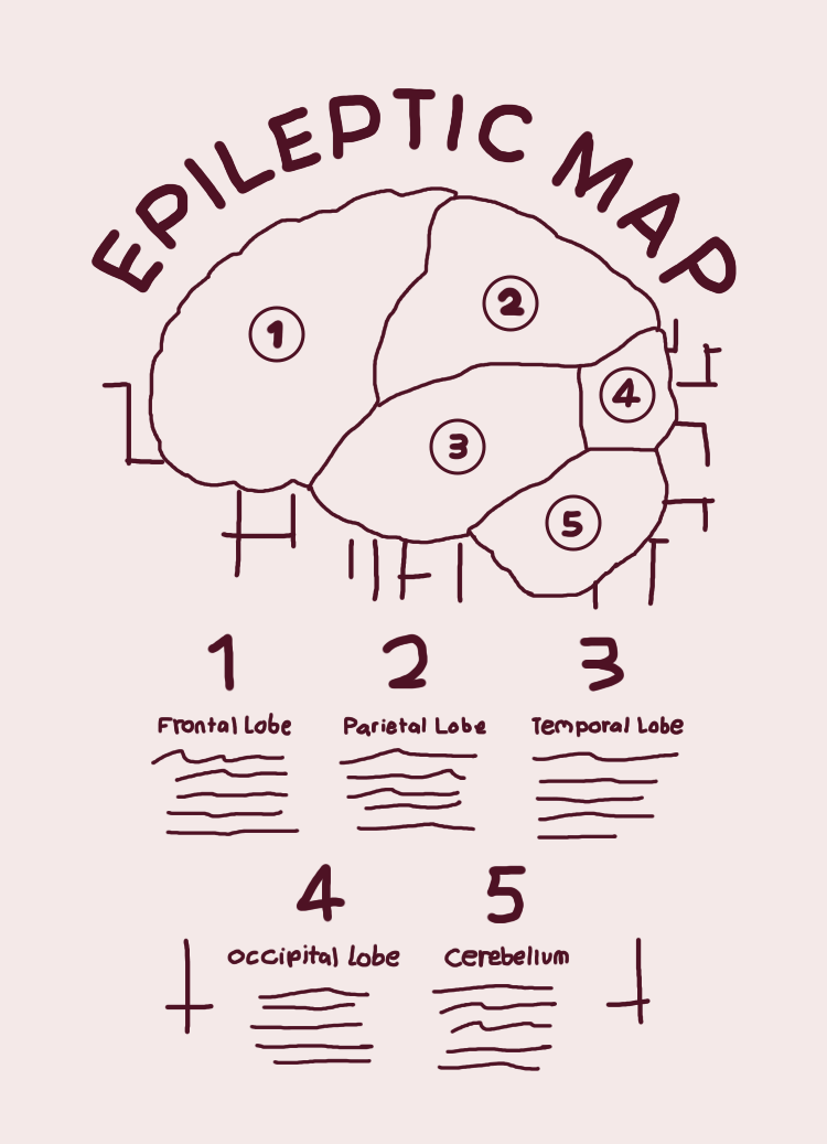 A diagram of the brain labeled 'Epileptic Map' showing five sections, along with their corresponding names and descriptions: 1. Frontal Lobe, 2. Parietal Lobe, 3. Temporal Lobe, 4. Occipital Lobe, 5. Cerebellum.