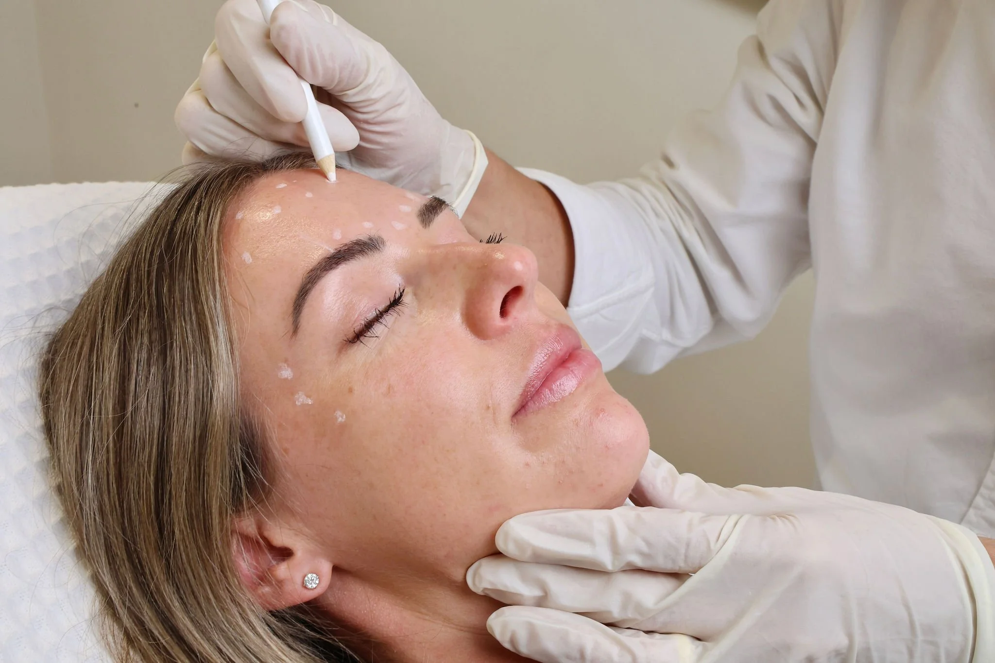 A woman lying with eyes closed, receiving a cosmetic treatment on her forehead from a professional wearing gloves.