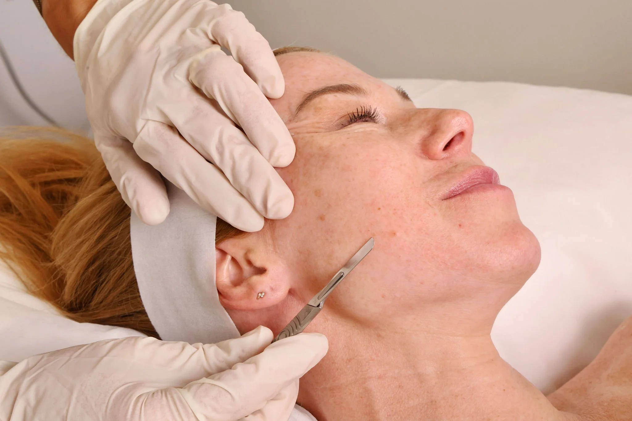 A woman receiving a facial treatment from a professional wearing gloves, with a scalpel used to perform the procedure.