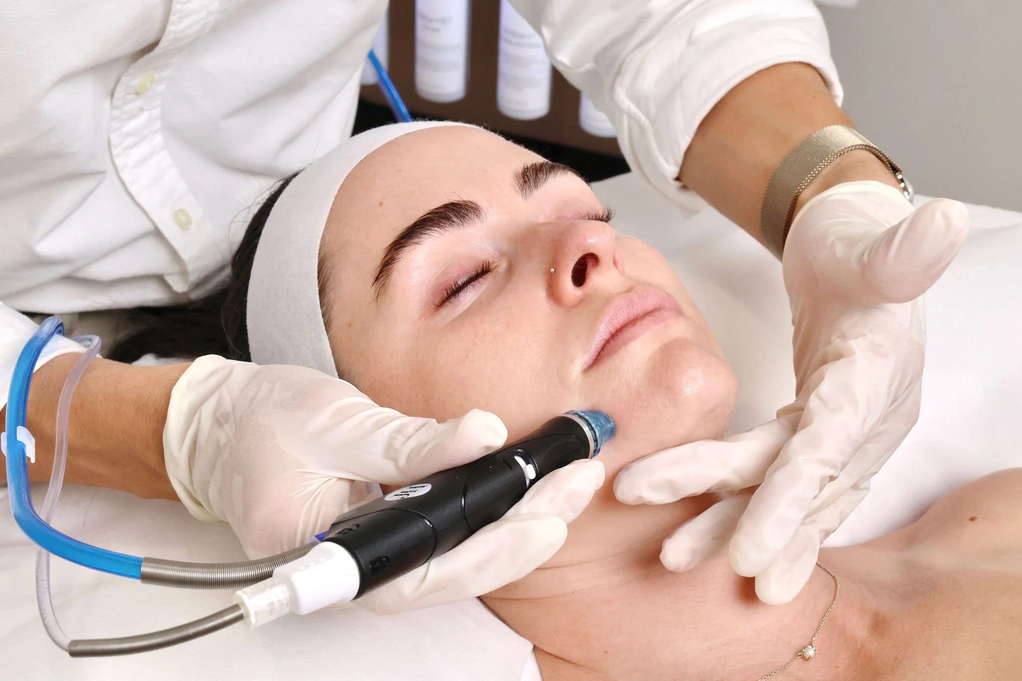 A woman receiving a cosmetic treatment on her face with a microneedling device while lying down with eyes closed, wearing a headband and jewelry, in a clinical setting