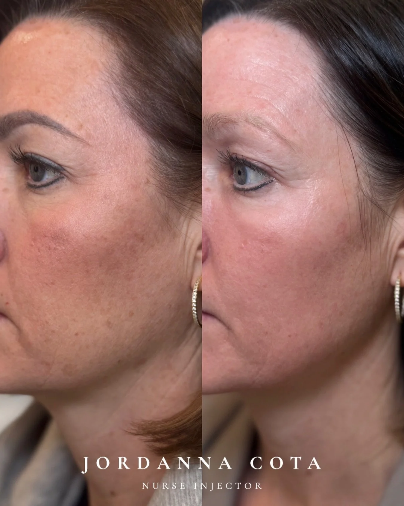 real skin. real results. all @zoskinhealth
&bull;

&bull;

&bull;
#zoskinhealth #zoskincare #medicalaesthetics