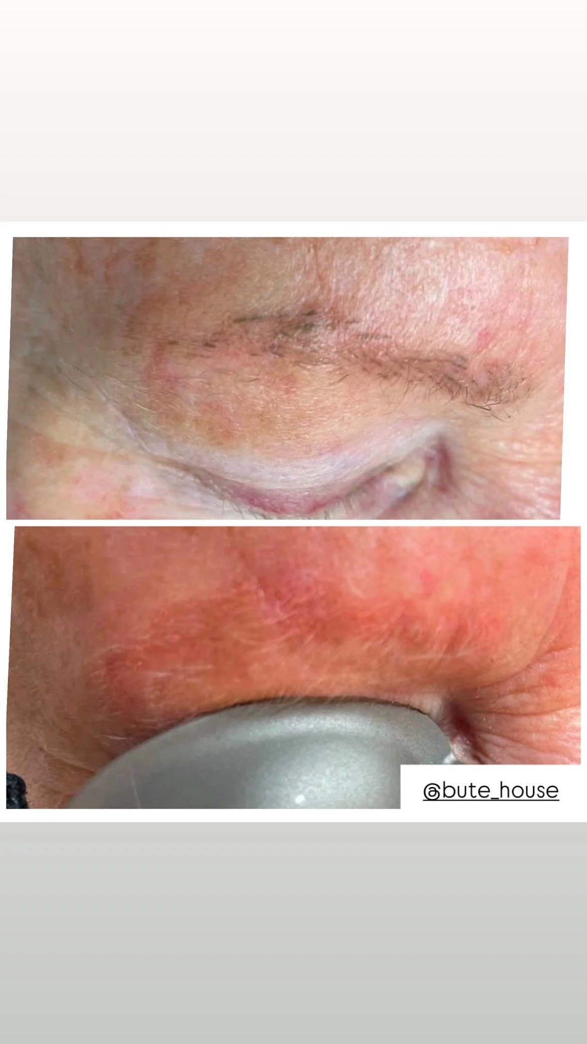 Eyebrows by Bute House Aesthetics