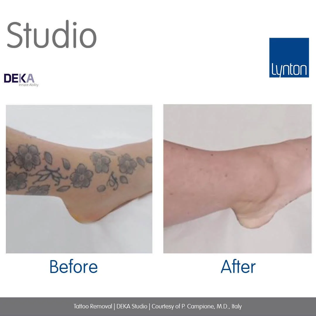 Complete before and after- 1.jpg