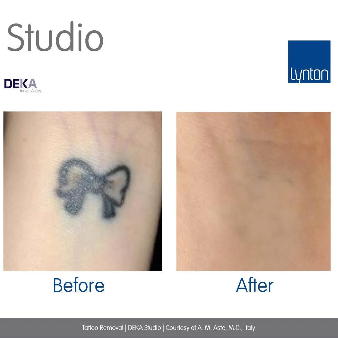 Complete before and after- 2.jpg
