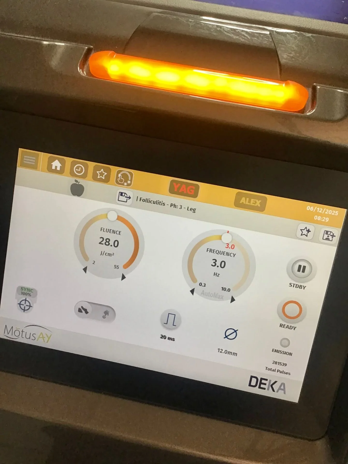 Extremely busy day in the laser clinic today, starting with 1/2 leg folliculitis treatment ⚡️ 

Get in touch to start your laser journey!
#laserseason #laserhairremoval #folicul&iacute;tis #laserclinic #dekalaser #suffolk #cambridgeshire