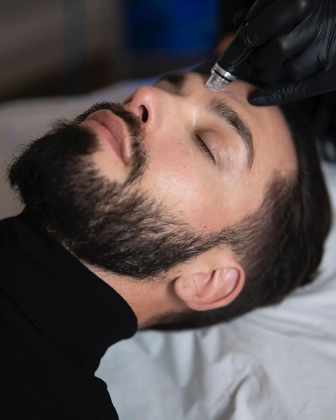 Men&rsquo;s skin needs love too. Hydrafacial deeply cleans, extracts, and hydrates in one session. Simple, effective, and you see the glow straight away ✨

@hydrafacial_uk #hydrafacialuk #hydrafacial #skintreatment #healthyskin #skinhealth #skincare 