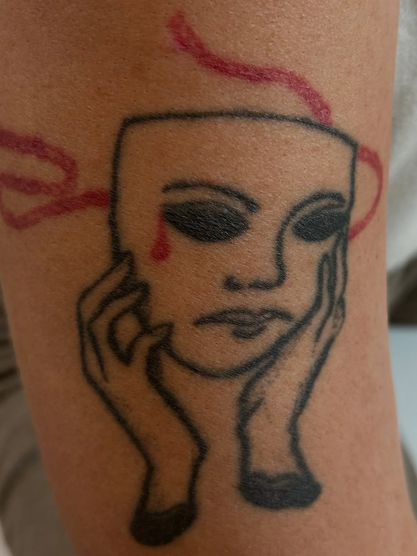 Making progress with this strong dark tattoo removal 🪄 
#lasertattooremoval #tattoo #tattoofade #laserclinic #newmarketsuffolk