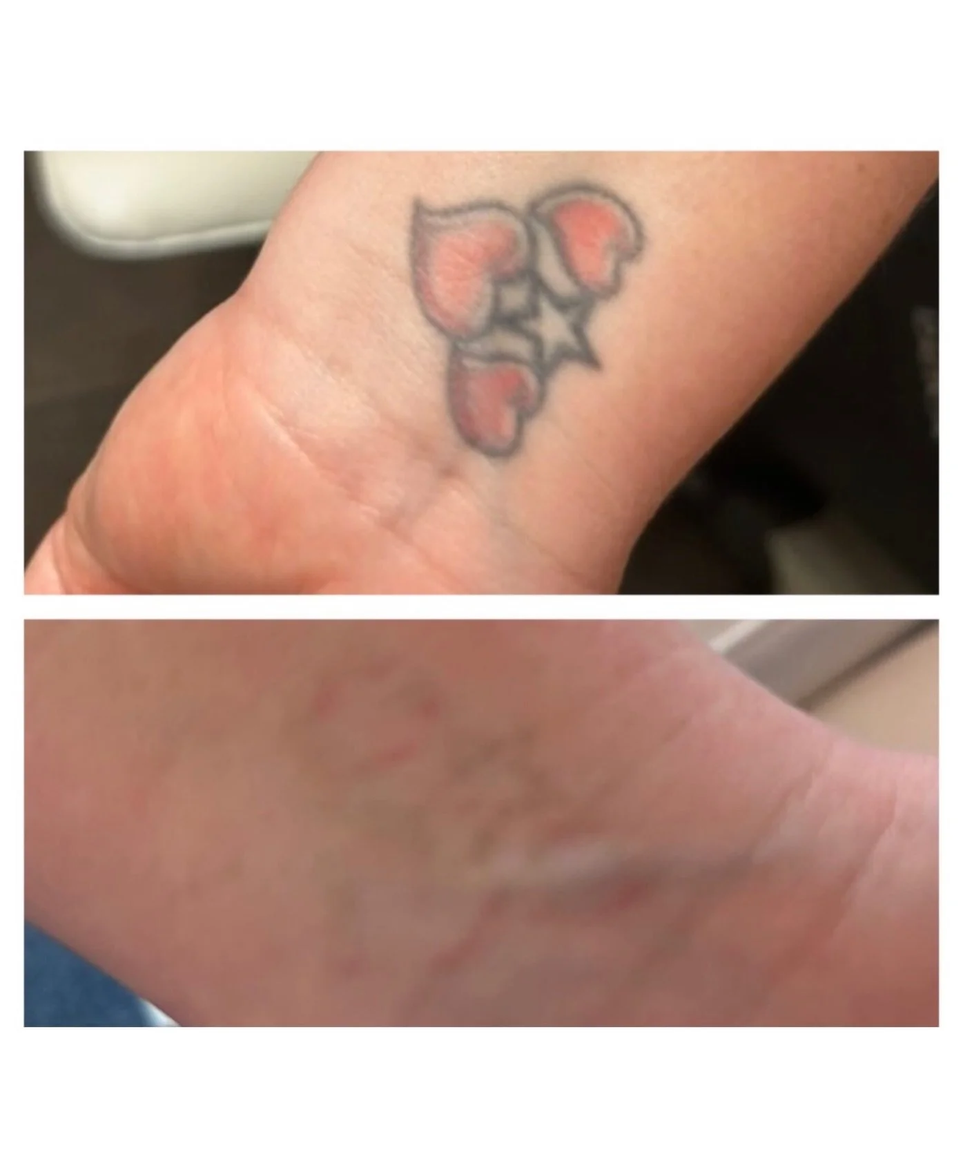 🚨 THIS WEEKEND ONLY 🚨
50% off all tattoo removal courses 👀

1/2 price unlimited tattoo removal- tell a friend! 

Don&rsquo;t miss out, get rid of tattoo regrets, start now! 
We will not repeat this amazing offer 🚨

#tattoocoverup #tattooremoval #