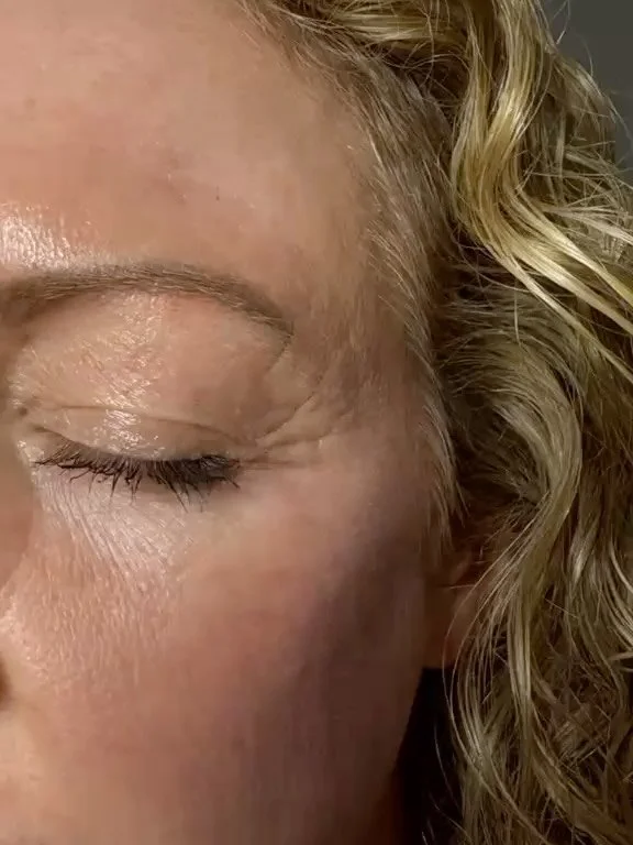 🎉 DERMAFILLIC has arrived 🎉

Experience the ultimate in skin optimisation with our flagship treatment, combining the power of Dermapen Microneedling and HydraFacial, enhanced with the HydraFillic Pep9&trade; infusion.

🎉LIMITED TIME- introductory 