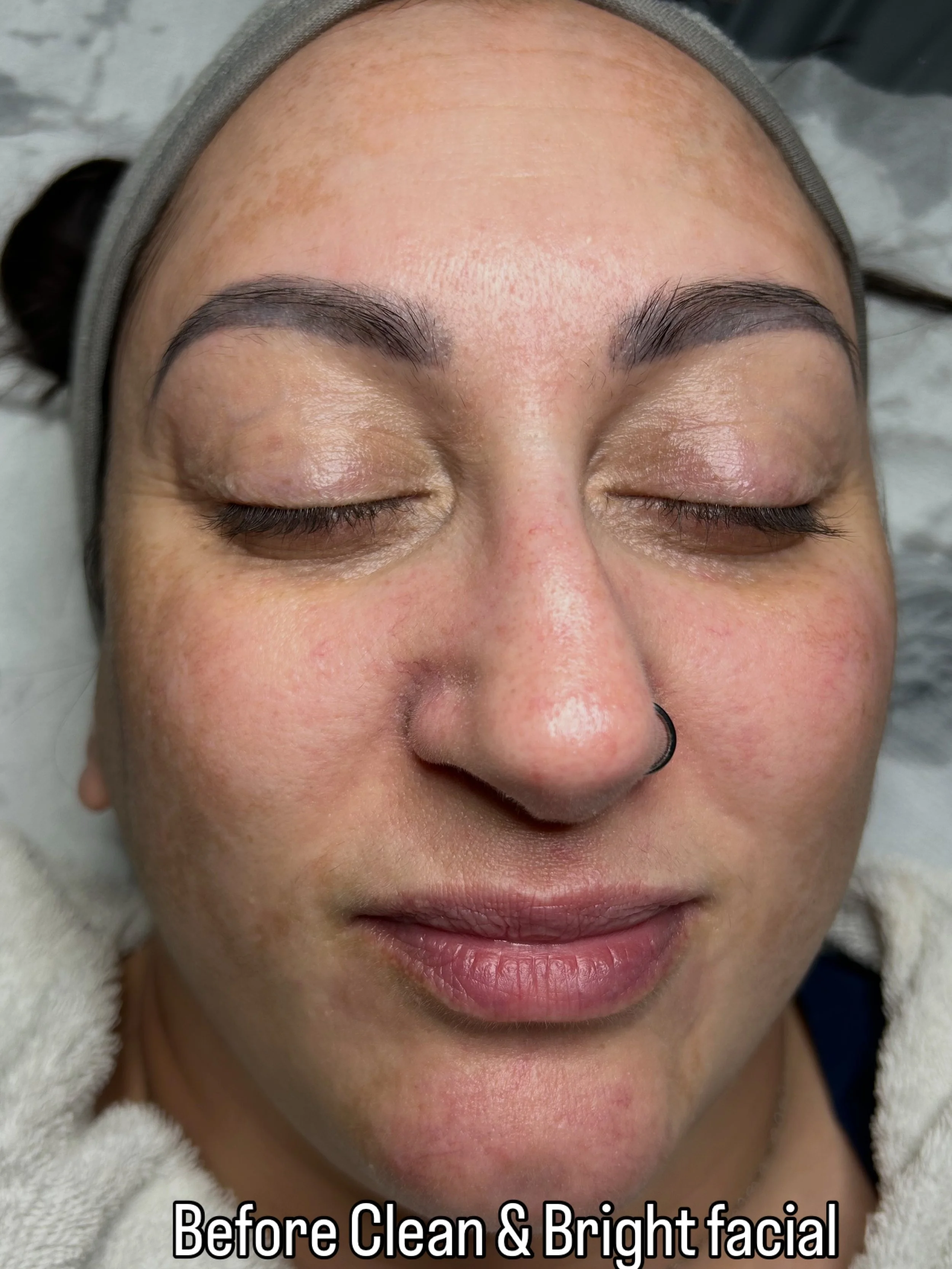✨ AVAILABLE NOW - our brand new &ldquo;Clean &amp; Bright&rdquo;facial programme ✨ 

Our complete 4-week skin brightening system
Combining two in-clinic treatments 
PLUS 
The powerful iS Clinical-  Extra Strength Active Peel Home System 

(Box of 15 