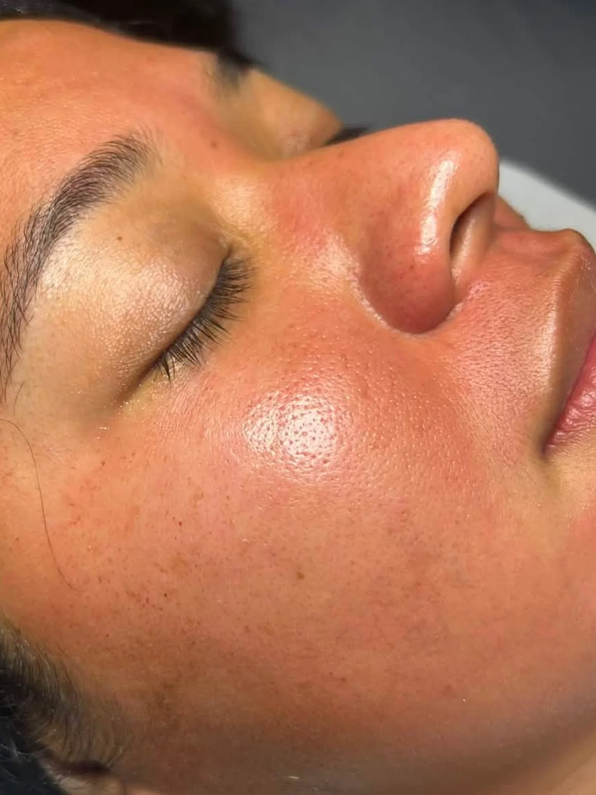 That post-treatment glow at Bute House Aesthetics 🤍

Our Dermapen microneedling treatment works by creating controlled micro-channels in the skin, helping to stimulate the skin&rsquo;s natural repair response and support fresh collagen production.

