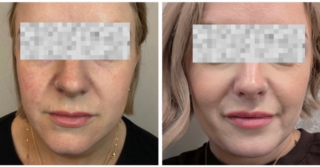 ✨APPOINTMENTS WITH NATALIE✨
If you haven&rsquo;t met Natalie yet, she will be holding a clinic with us tomorrow
FRIDAY 25th SEPTEMBER 

Book a consultation online or send a DM for more info. 

#aesthetics #newmarketsuffolk #FacialContour #FacialBalan