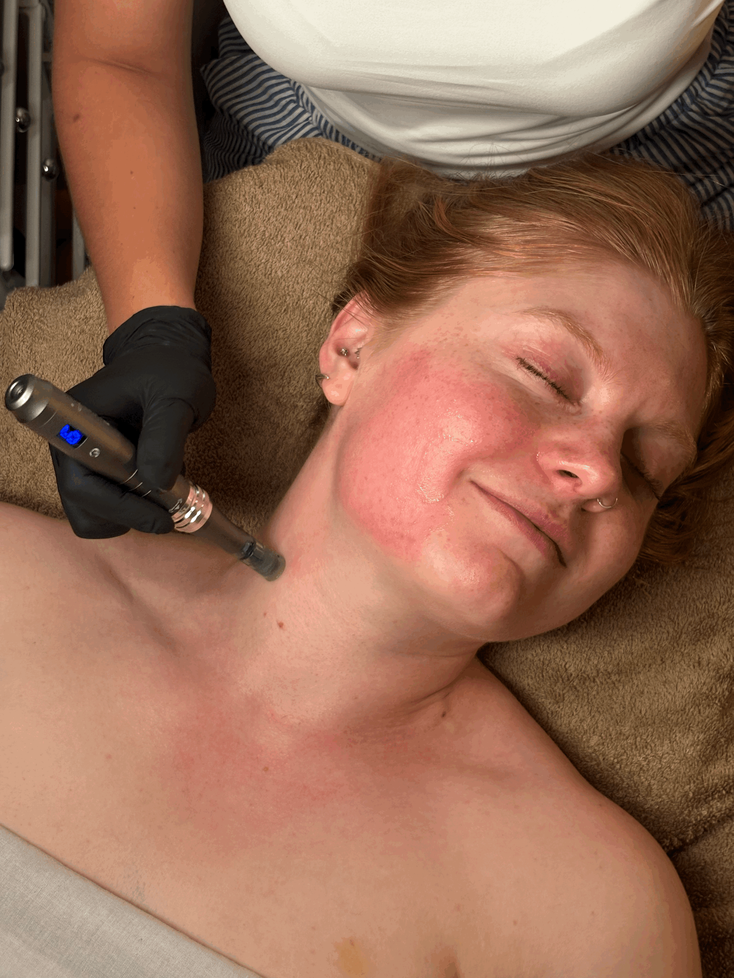 More Than Microneedling: The Georgie Glow Experience