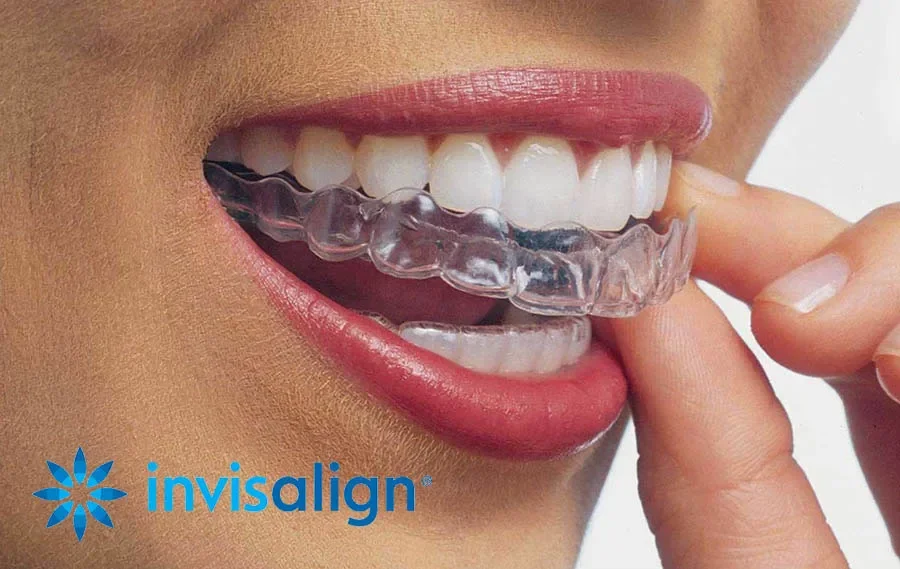 Invisalign Dentist
