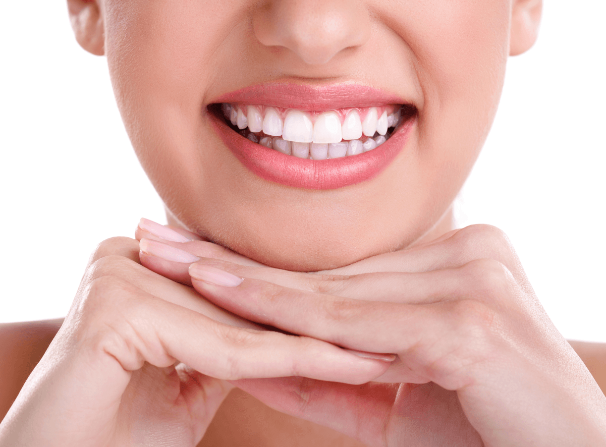 Snap-On Smile