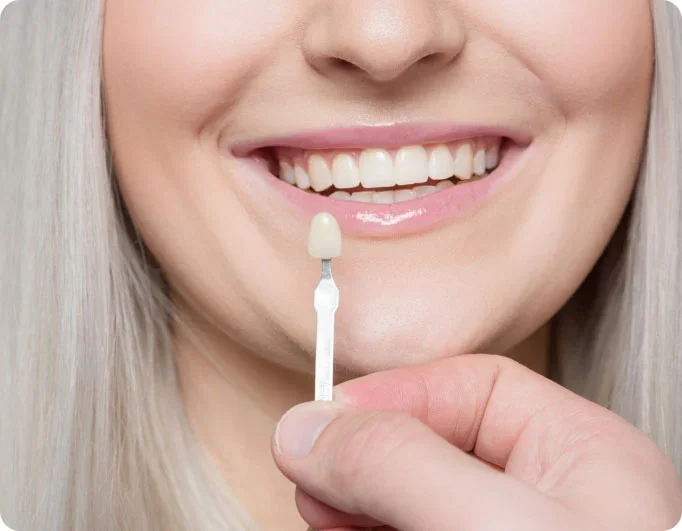 Dental Veneers & Laminates